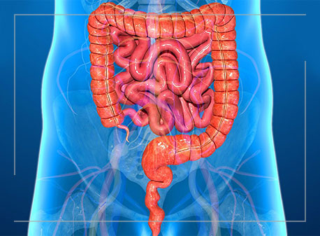 colitis