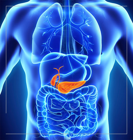 pancreatitis