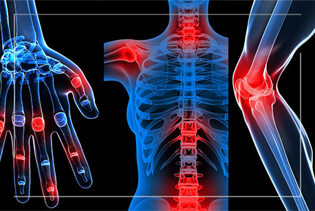 Rheumatoid Arthritis Treatment in Ayurveda, Ayurvedic 