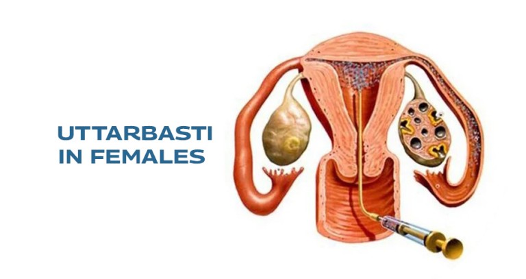Uttarbasti-in-Females