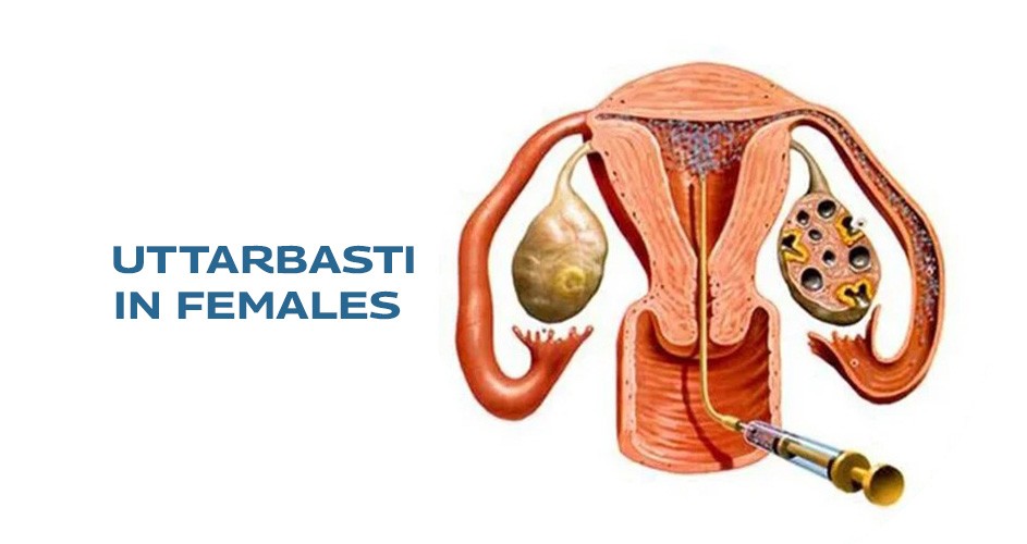 Uttarbasti-in-Females