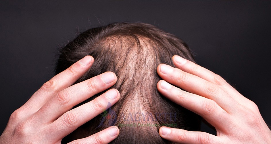 Pracchana-karma-(scraping)