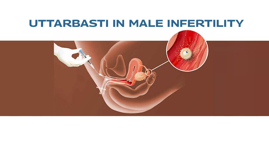 Uttarbasti-in-Male-Infertility