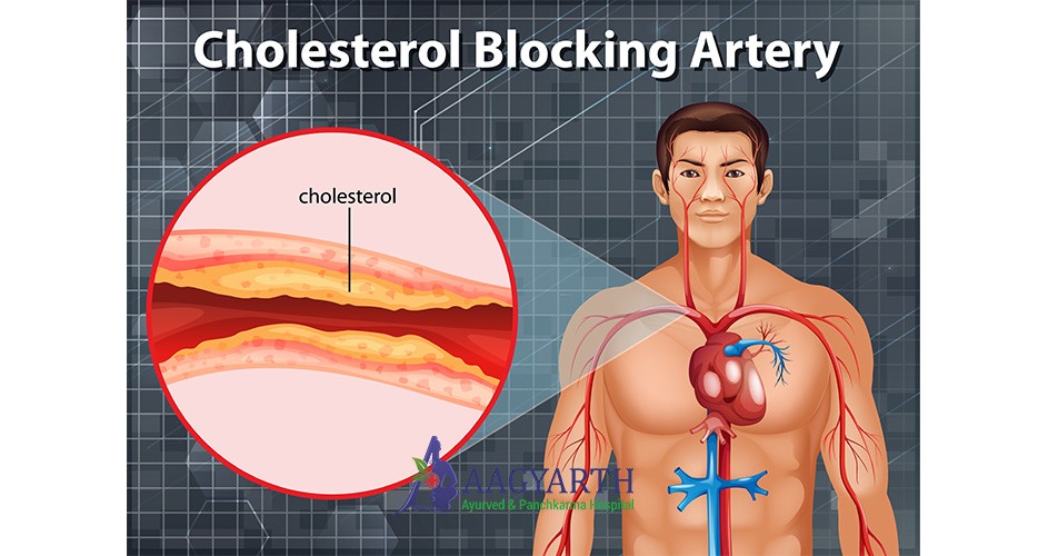 Cholesterol-Treatment