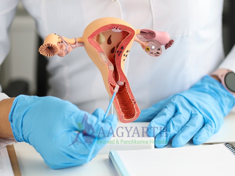 Best-Adenomyosis-Treatment-in-Ahmedabad