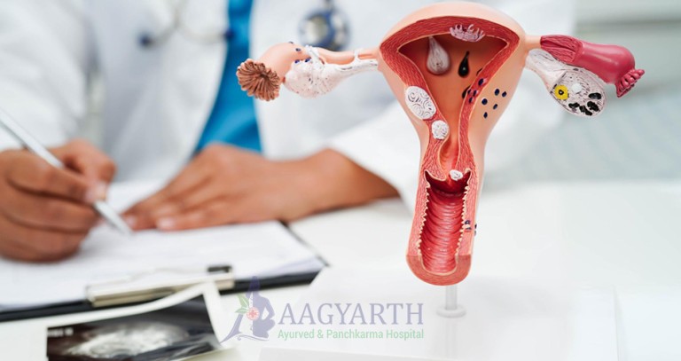Endometriosis-Treatment
